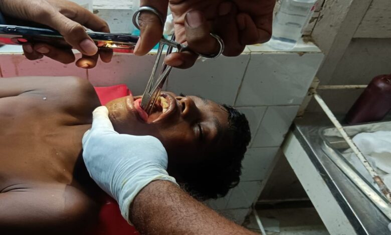 बच्चे के मुँह में तालाब में नहाते समय घुसी मछली, देखें वीडियो...