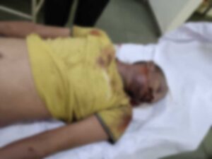 RAIPUR: राजधानी में पत्नी ने boyfriend से करवाई ऑटो चालक पति की हत्या, पढ़े पूरी खबर...