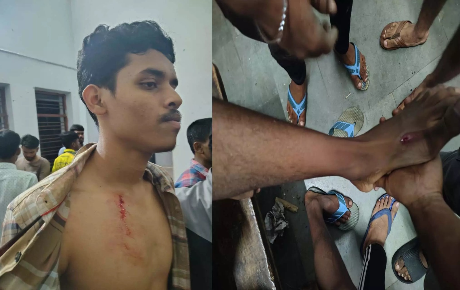 रायपुर साइंस कॉलेज हॉस्टल में बाहरी युवकों की गुंडई, स्टूडेंट्स पर हमला और तोड़फोड़ – आधी रात थाने का घेराव...