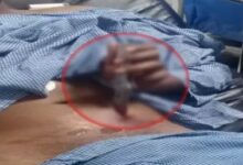 Raipur Breaking: आजाद चौक में युवक पर चाकूबाजी, पेट में फंसा चाकू; हालत गंभीर, नाबालिक पर हत्या के प्रयास का केस दर्ज...