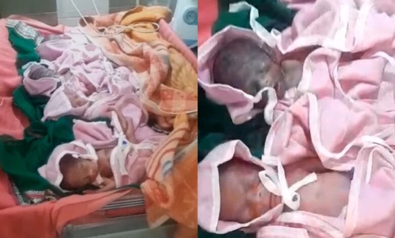 Chhindwara Four Babies: जब ऊपर वाला देता है तो छप्पर फाड़ के देता है ,छिंदवाड़ा में एक साथ चार बच्चों का जन्म, मां और नवजात पूरी तरह स्वस्थ…