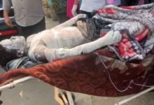 रायगढ़ में मंगल कार्बन प्लांट ब्लास्ट: 9 माह के मासूम समेत 8 मजदूर झुलसे, हालत नाजुक…