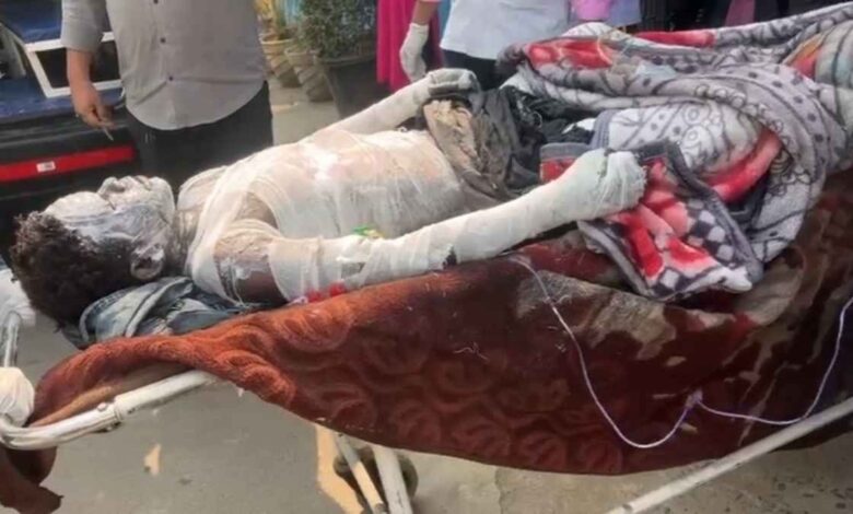 रायगढ़ में मंगल कार्बन प्लांट ब्लास्ट: 9 माह के मासूम समेत 8 मजदूर झुलसे, हालत नाजुक…